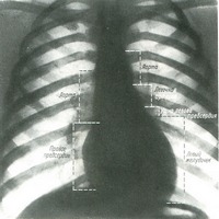 Рентгеноанатомия