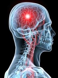 brainmetastases